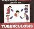 tuberculosis.JPG